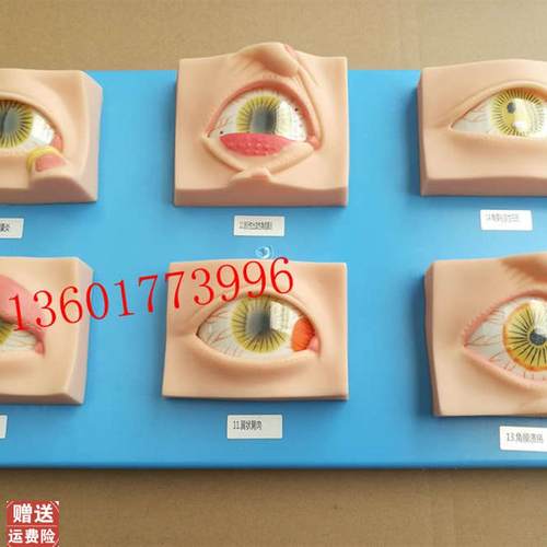 人体常见眼病模型常用眼r科疾病模具眼病模型20种常见眼球病变模