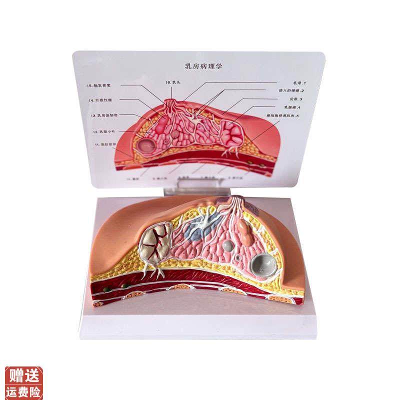 乳房模型乳腺增生家政培训妇产乳腺E演示哺乳期乳房构造催乳师教,文具电教/文化用品/商务用品,教学仪器/实验器材,淘宝优惠券,粉丝福利购,淘宝优惠卷