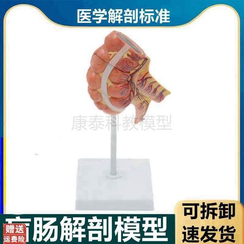 盲肠解剖模型阑尾肠系膜r淋巴血管结肠空肠回肠人体肠道病理医患