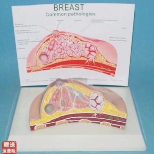 女性乳房病理模型乳房解剖结构医用教Y学讲解展示