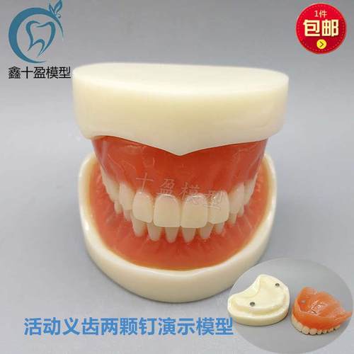 牙科模型活动义齿牙模讲解模型全口义齿两颗钉教学模X型T21包邮
