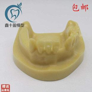 牙科材料下半口i种植练习模型发泡缺失种植练习教学模型M2028