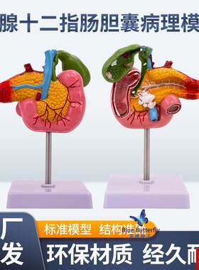 学胰腺十二指M肠胆囊病理模型 胆结石外科消系统肝胆科模型