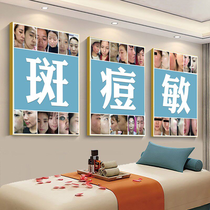 祛斑祛痘海报痘印痤疮图片美容院点痣宣传画斑痘敏广告对比图挂画