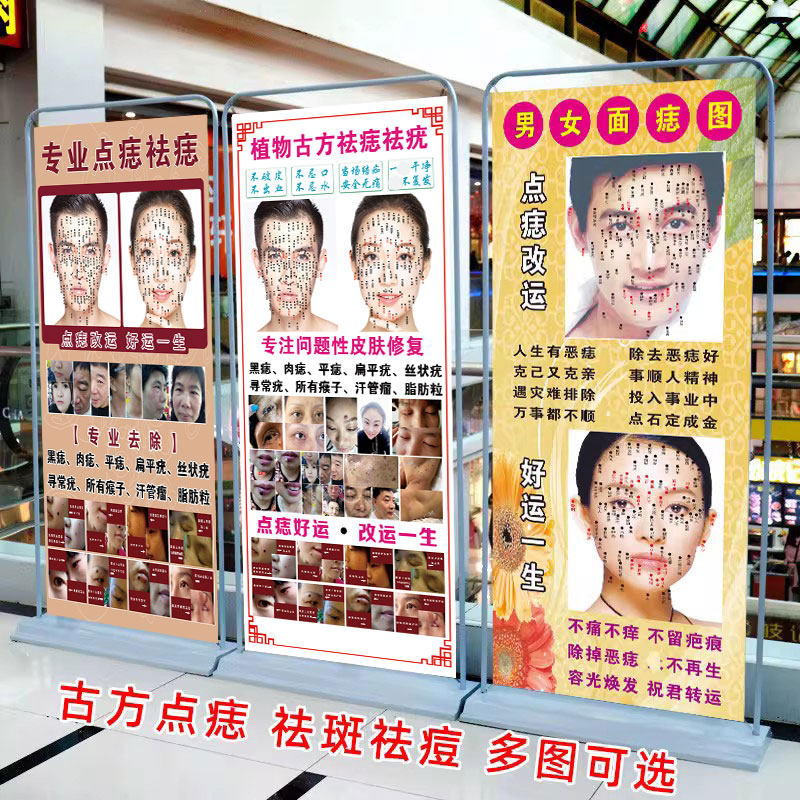 男女面痣图祛斑祛痘取痣宣传画展架面部开运点痣图祛痣祛疣广告图