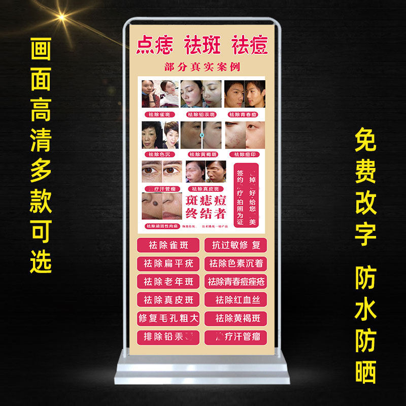 专业祛斑祛痘广告点痣海报宣传画祛疤对比图中药门型展架祛斑图片