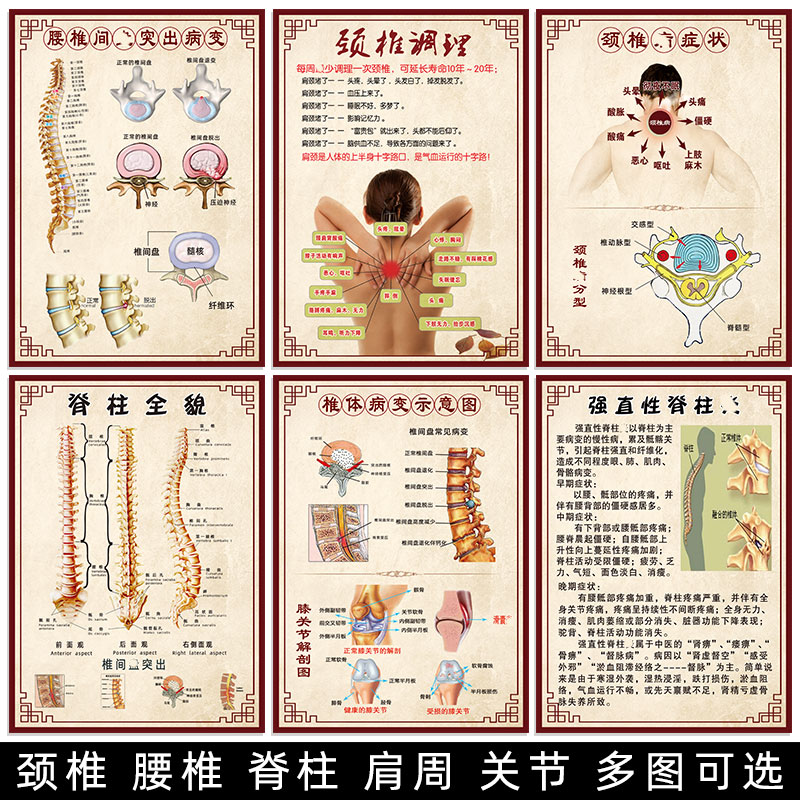 颈椎图片肩周炎海报颈椎病腰椎脊柱图骨质增生墙贴画富贵包宣传画