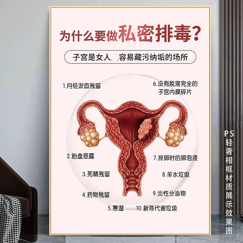 私密抗衰海报子宫排毒挂画妇科保养装饰画产后修复广告女性炎症图