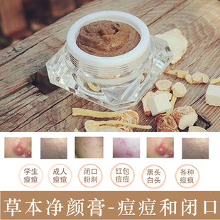 草本配方中草净颜痘痘膏青春痘学生痘成人痘闭口粉刺红包痘螨印坑