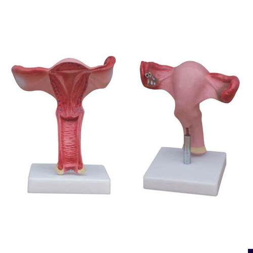 子宫模型女性子宫放大解剖模型生殖系统生理结构教V育卵巢妇产教