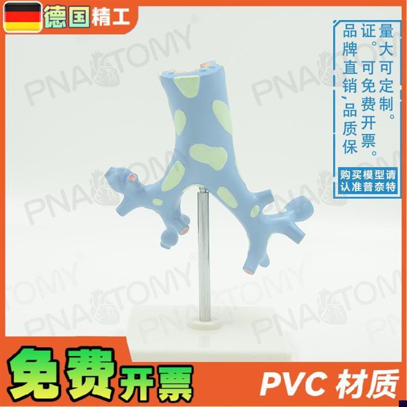 德国】新品人体呼吸系q统病理肺部支气管树解剖模型教学呼吸科标