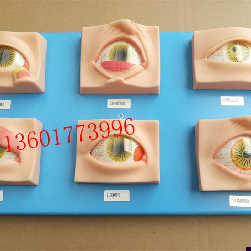 人体常见眼病模型常用眼科疾病模具眼病模型20种常见Y眼球病变模