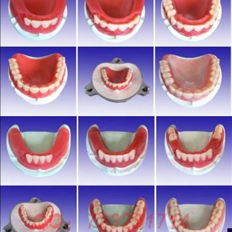全口牙制作步骤