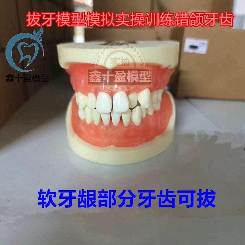 牙科8016拔牙练习p模型软牙龈树脂牙齿医患沟通练习带牙根错颌模