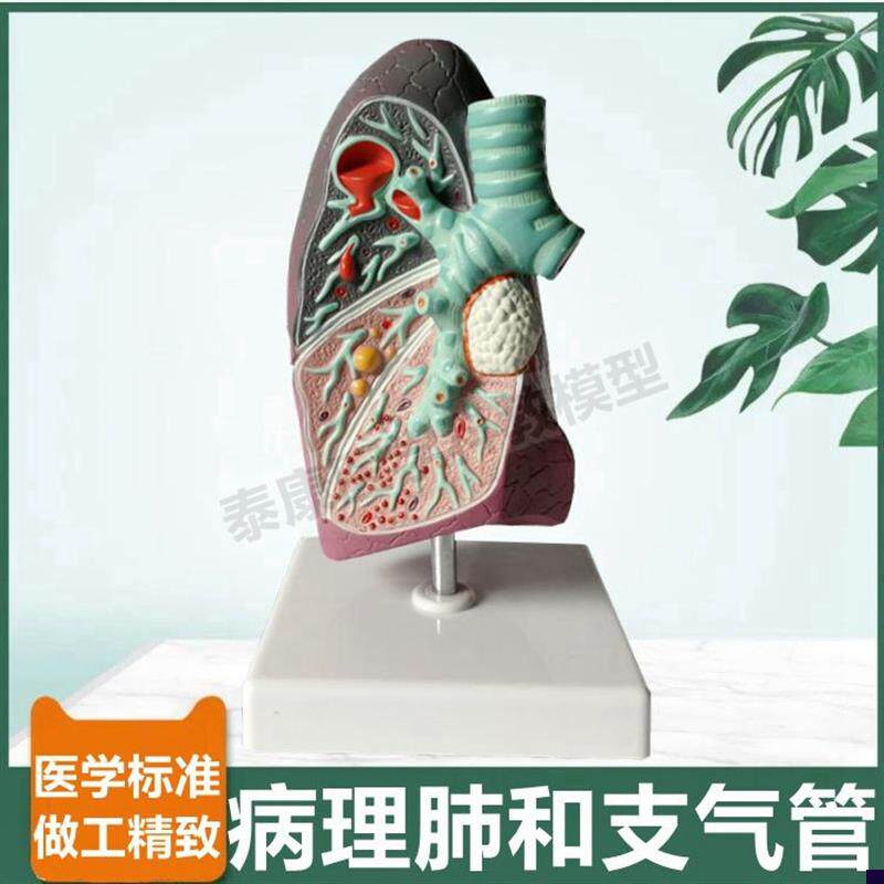 病理肺组a织呼吸器官支气管树人体肺血管细支气管医患沟通医用教