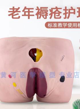 教学模型医院培训老年人褥疮护理模型压疮护理模V型养老护理训练