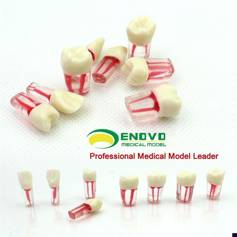 ENOVaO颐诺口腔科根管离体牙模型牙体牙髓学根管充填制备8个牙位