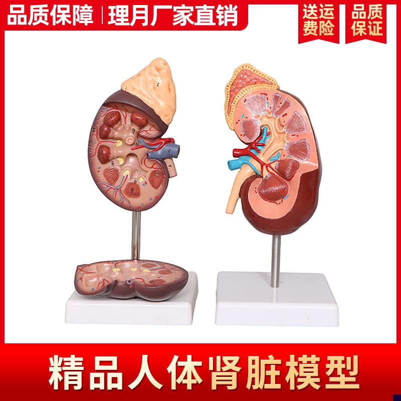 肾解剖模型标准人体肾脏肾上腺放大模型病M变肾脏内脏器官医学教