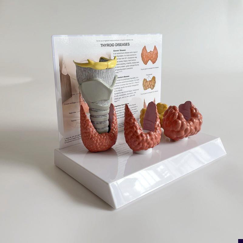 甲状腺模型人体内分泌系统囊大肿增医药促L销礼物医患教育展示医
