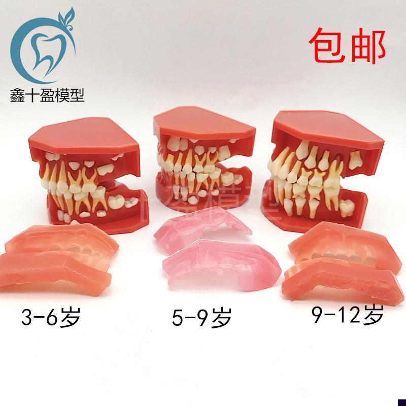 儿童乳牙替换牙齿模型乳恒牙交替3个阶段口腔O5-9髓牙列发育模型