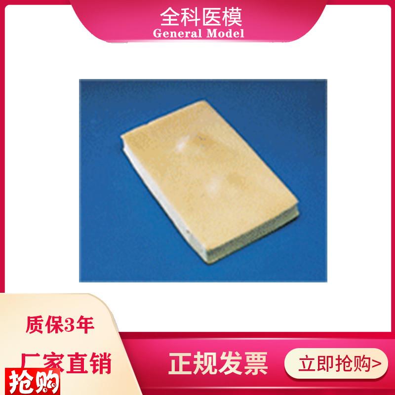 脂肪瘤切除术练习模块