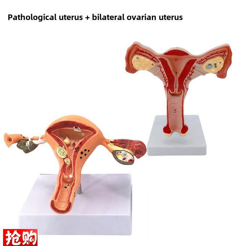 女性生殖模器模i型女性生殖模器模型私密子宫模型教具妇科卵巢解