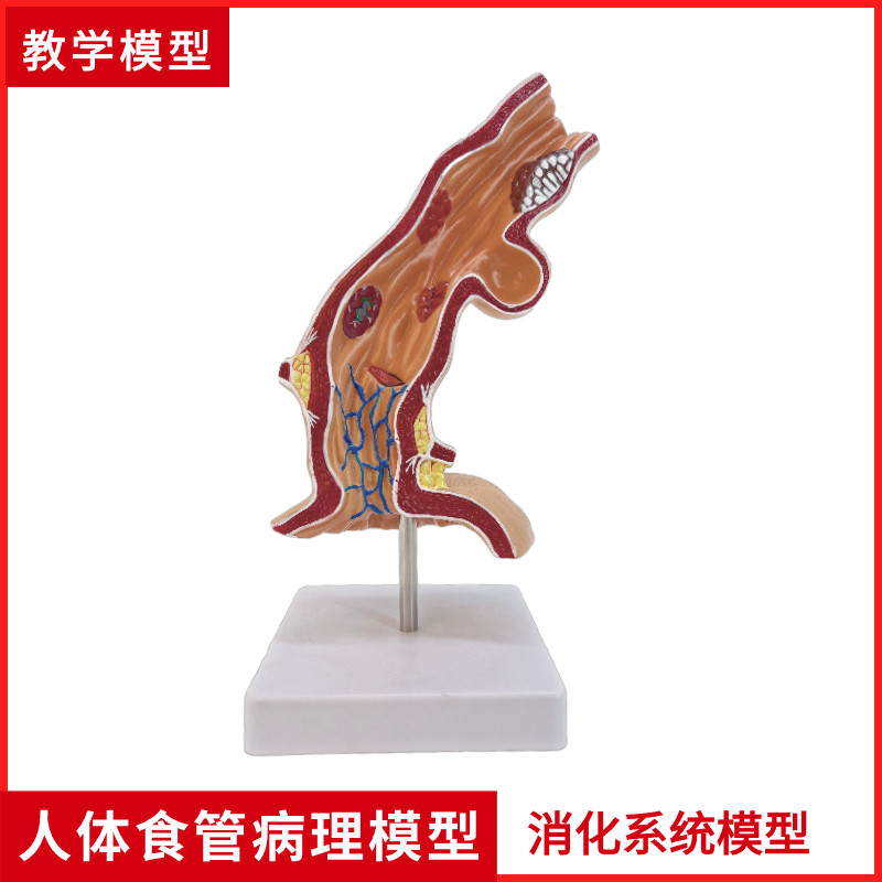 食管解剖模型食道消化系统科室医用教F学胃部呼吸器官人体器官解