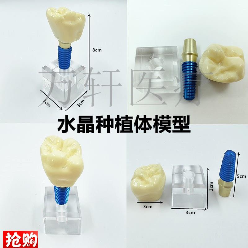 牙科口腔种植体模型水晶种植体牙模可拆卸口腔教学U模型齿科小水