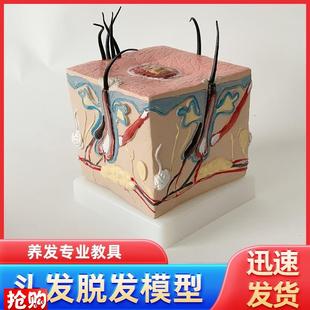 人体毛发脱发模型头发头皮发炎毛细血管毛囊收缩教V学教具演示模