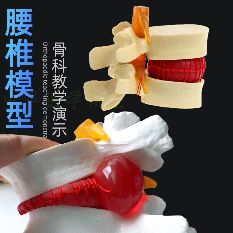 人体脊椎骨头腰椎间盘模具脊柱模型椎体模L型突出受压病理骨质教