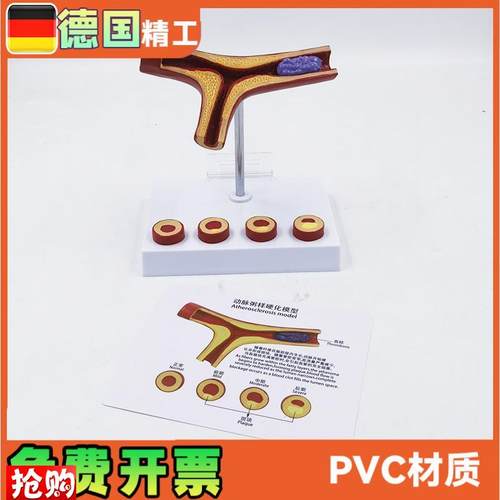 德国】动脉模型血k栓冠心血管解剖教学医药礼品健康管理教具医学