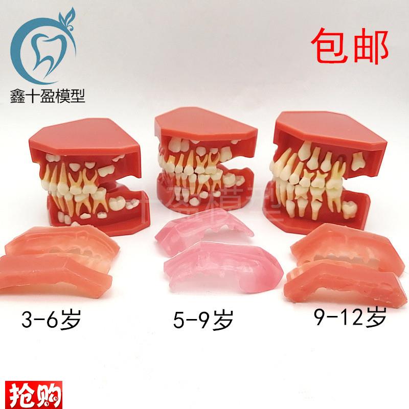 儿童乳牙替换牙齿模型乳恒牙交替3C个阶段口腔5-9髓牙列发育模型