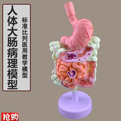 人体消化系统解剖模型大肠模型直肠十二指肠内脏肠U胃解剖构造模