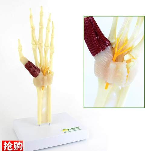 ENOVO颐诺人体腕关节综合征模型腕管综合征正W中神经肘关节桡