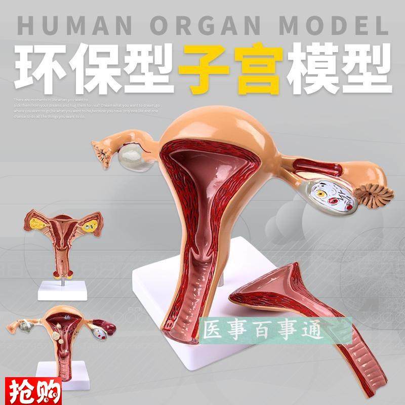 人体模型女性生殖子宫模型阴道卵巢模型J教学模具病理变化科学教