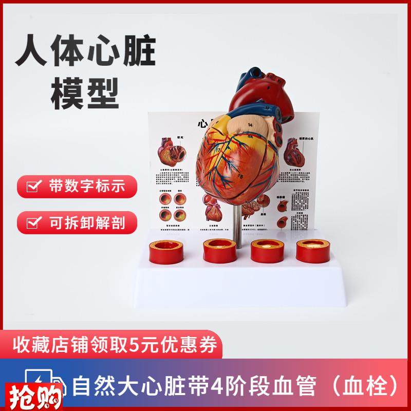 人体心脏模型四阶段血栓可拆卸冠状E动脉心血管血液循环解剖器官