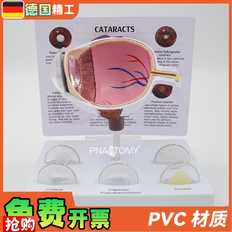 德国】眼球模型病理眼球演示教具眼科展示礼品人体V器官解剖模型
