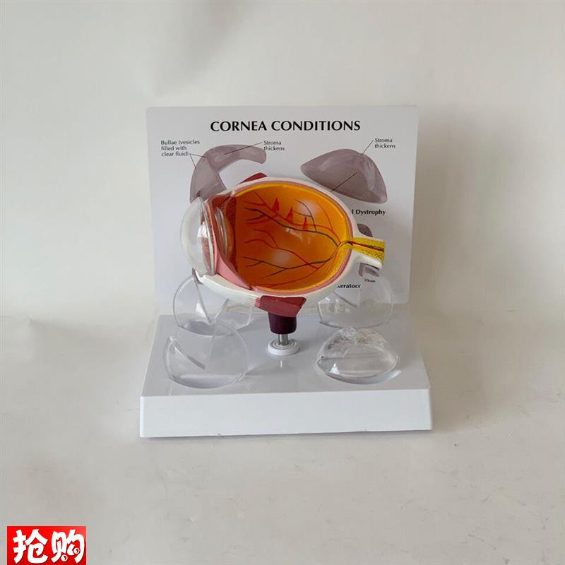 角膜模型视力感觉器官白内障青光眼视H网膜眼底眼科教学医患医药