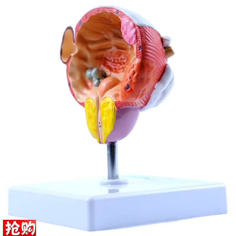 ENOVO颐诺人体膀胱前列腺疾病A演示模型男性泌尿外科医患沟通男科