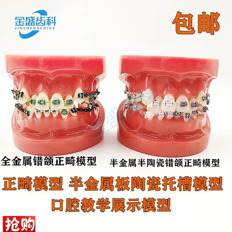 齿科口腔教学模型半金属半陶瓷托槽正畸M模型错颌矫正正畸模型