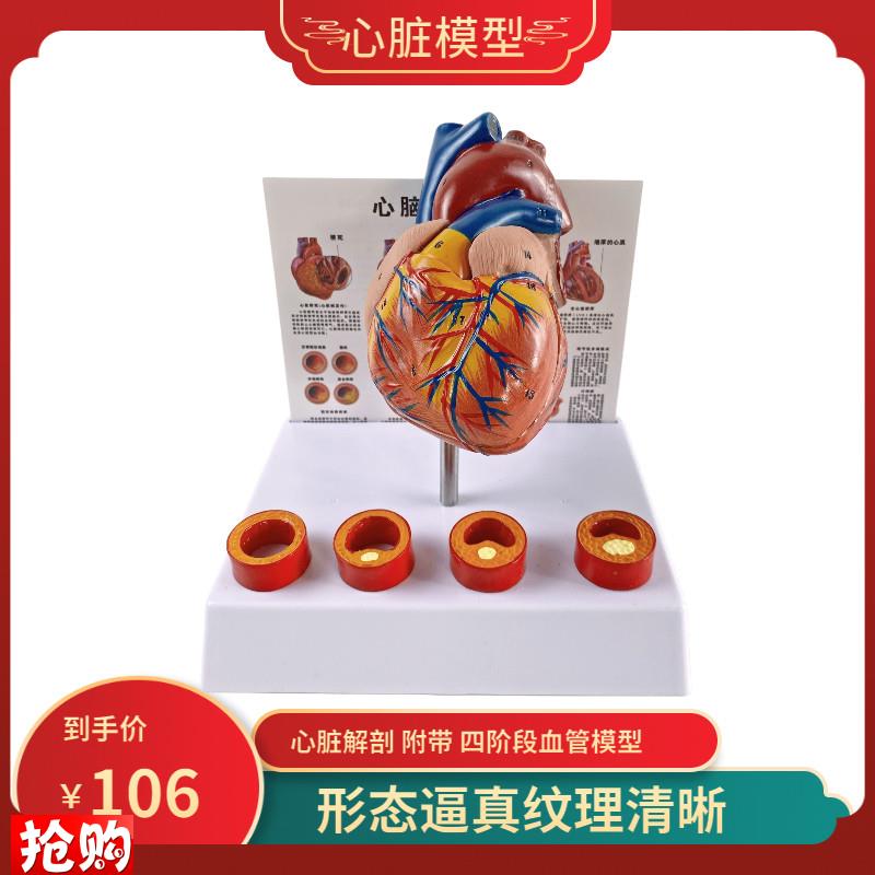 人体心脏模型四阶段血栓可拆卸冠状动J脉心血管血液循环解剖器官