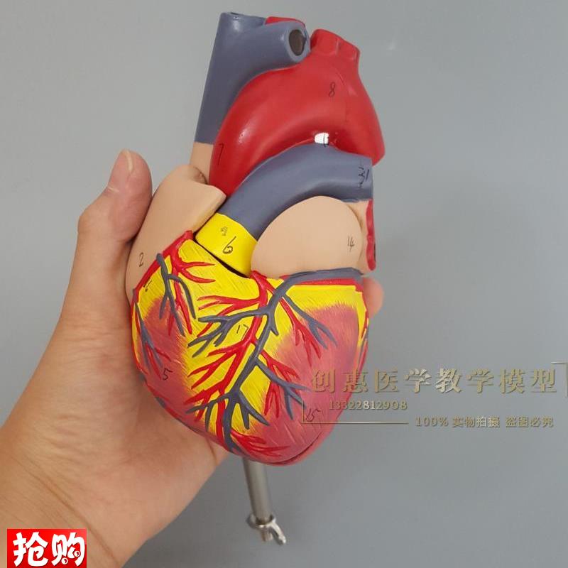 人体心脏模型医学心血管内科心D脏介入解剖教学冠状动脉包邮