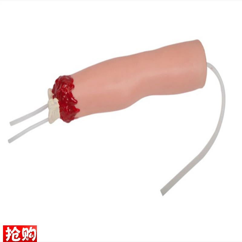 上肢外伤断肢止血模型