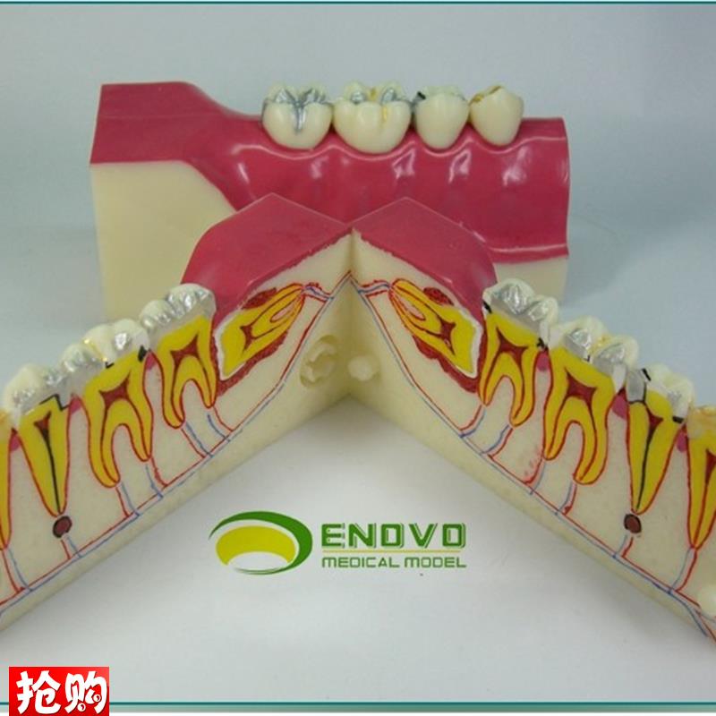ENOVO正品右下后牙组织分解模型牙齿L解剖牙列模型口腔科教学