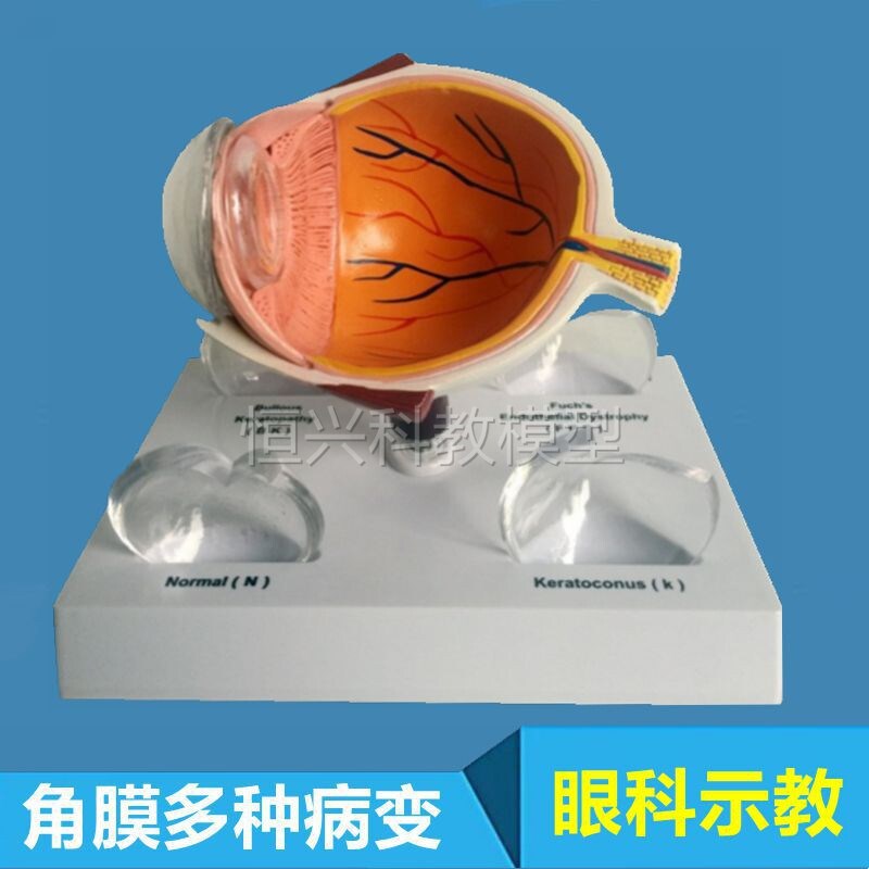 角膜模型常见病变视力模糊眼y球结构视网膜眼底血管视神经眼科医