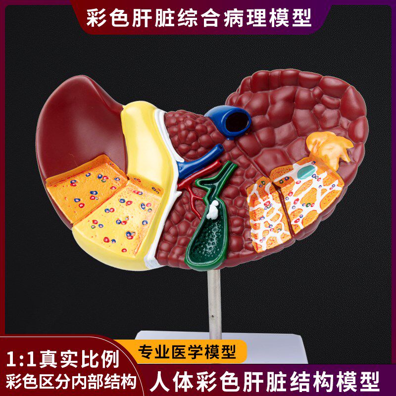 医学仿真人体肝脏解剖模型肝门z胆囊胆管结构消化系统器官演示教