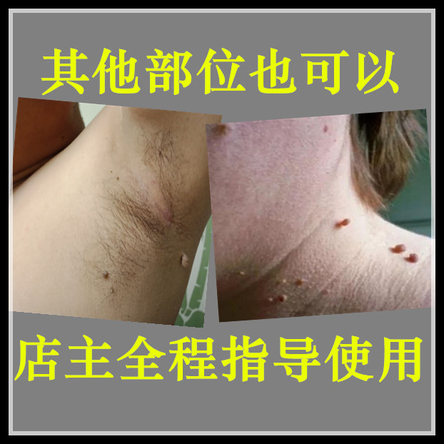 脖子腋下尤猴子私处小肉粒