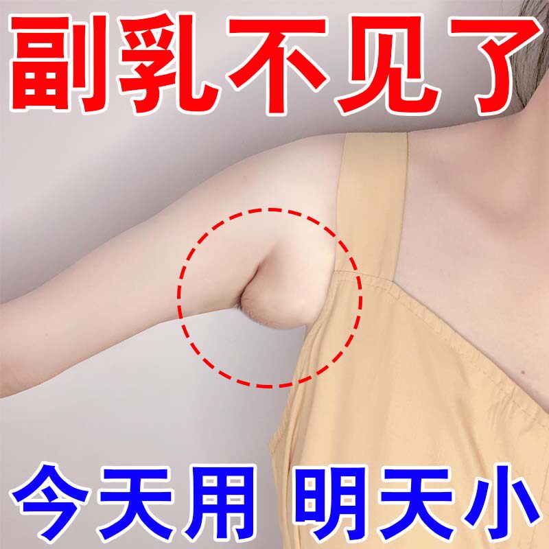 副乳副乳消除贴神器腋下淋巴疏通散肿大硬块胀痛去腋下赘肉药膏