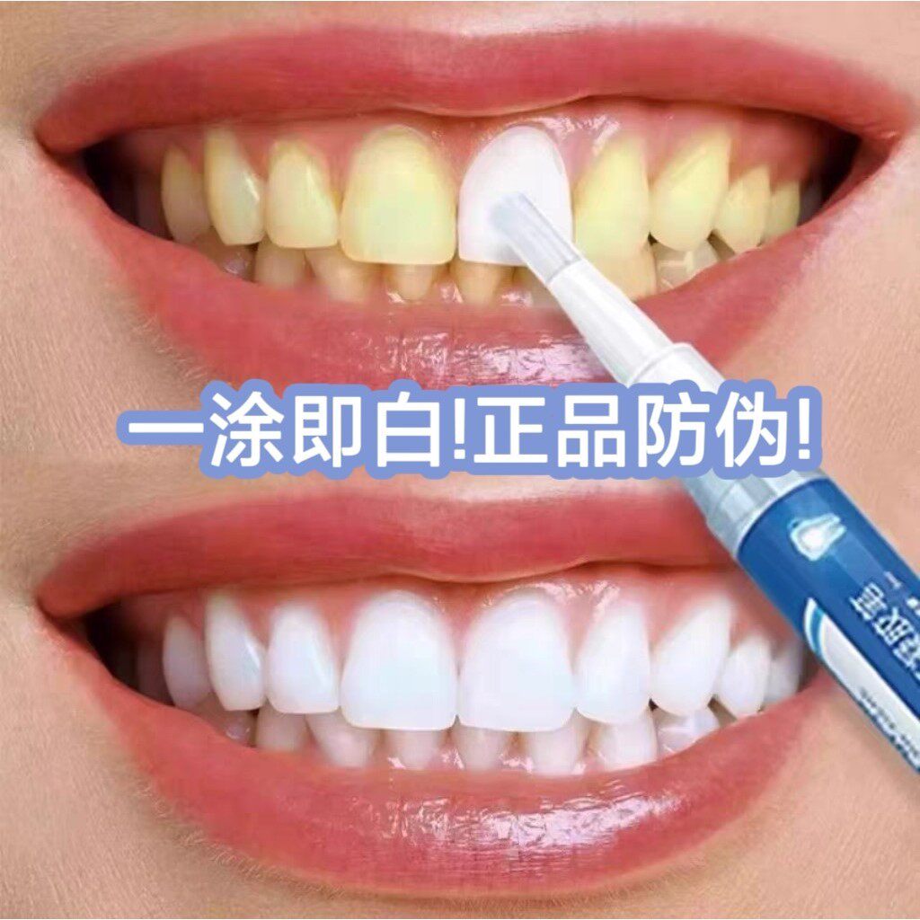 速效牙齿美白神器炫白洁牙笔去黄烟茶渍增白牙贴专克大黄牙咖喱笔