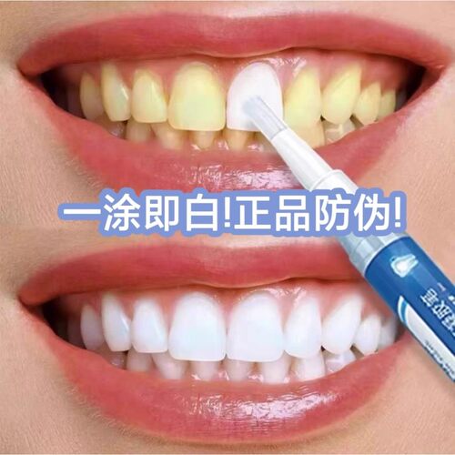 速效牙齿美白神器炫白洁牙笔去黄烟茶渍增白牙贴专克大黄牙咖喱笔